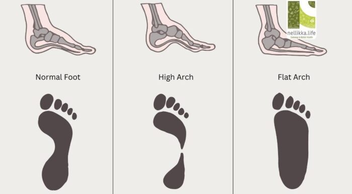 Goldilocks Foot: Striking the Perfect Balance for Healthy Movement