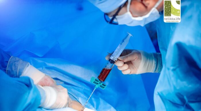 Why Bone Marrow Transplant Procedure Matters: A Life-Saving Treatment for Children