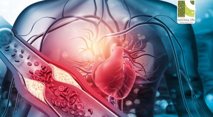 Coronary Heart Disease (CHD): The Silent Strain on the Heart