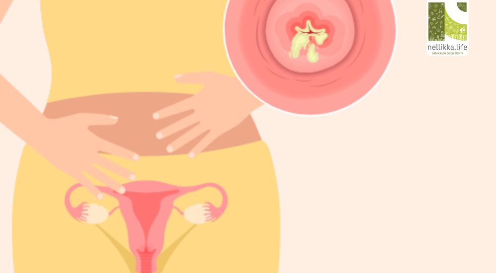 Why Do I Have Watery Vaginal Discharge?