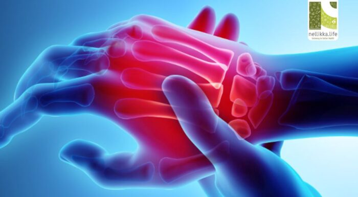 Demystifying Arthritis: Types, Symptoms, Affected Joints, Self-Care, and Treatment