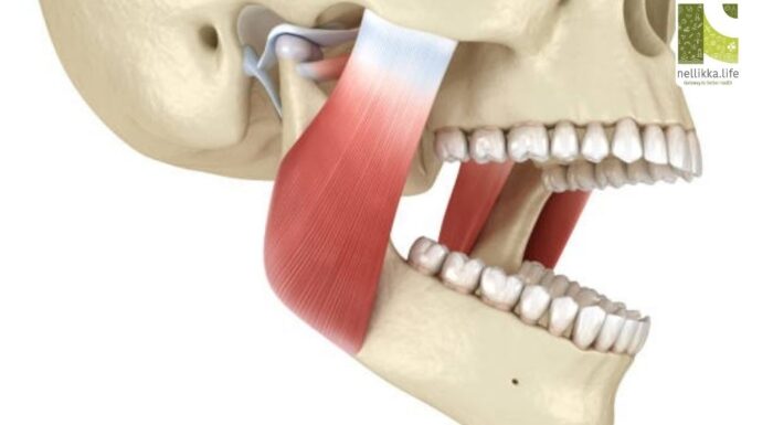 Lockjaw (Tetanus or Trismus): When the Jaw Refuses to Open — Causes, Symptoms, and Treatment