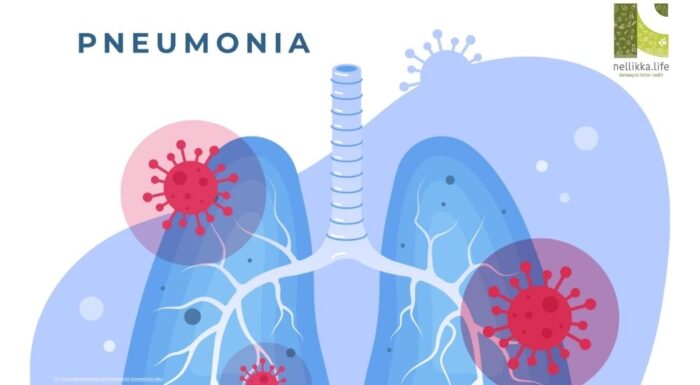 Pneumonia: The Silent Invader of the Lungs — Understanding, Recovery, and Prevention