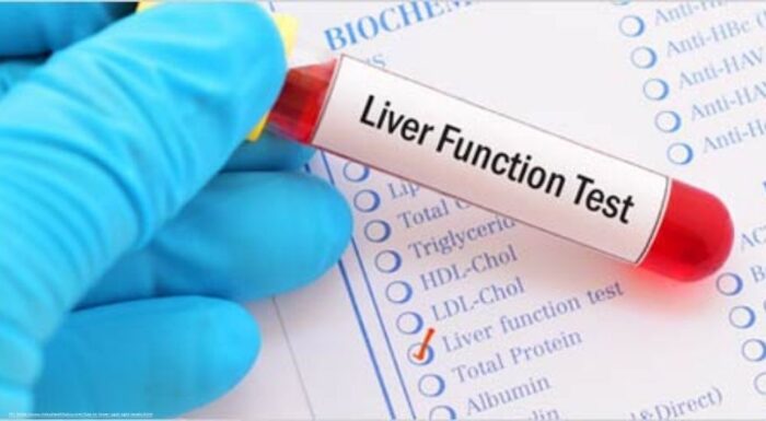 What Are SGOT and SGPT? Understanding the Liver’s Silent Signals