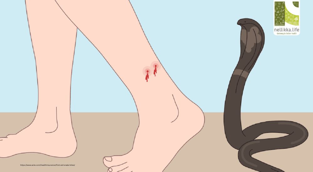Snake Bites: Immediate First Aid Remedies Before Reaching the Hospital