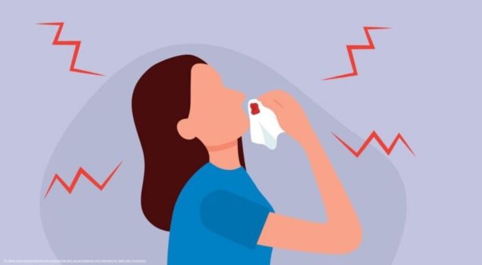 When the Nose Bleeds: The Science Behind a Dramatic Scene