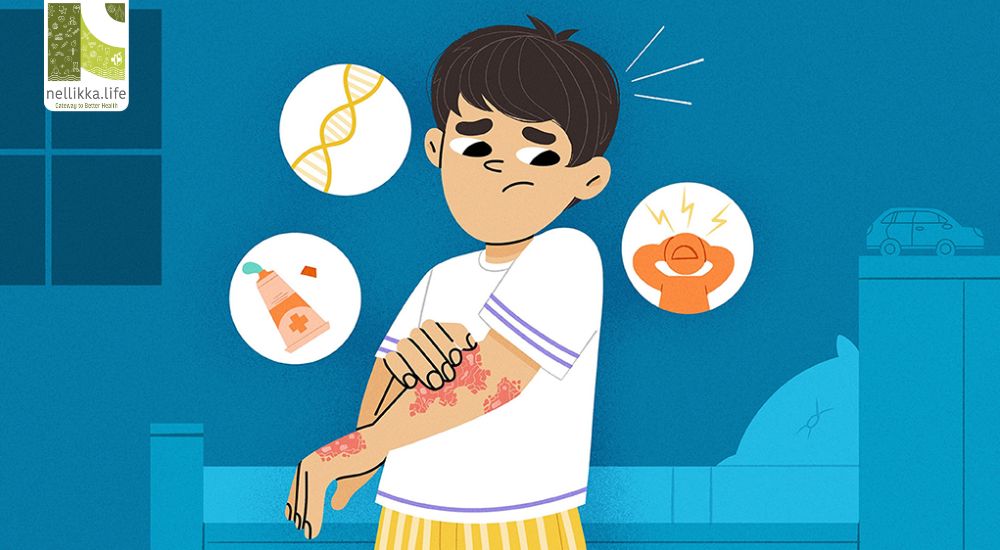 Psoriasis in Children: Understanding, Managing, and Healing the Skin from Within