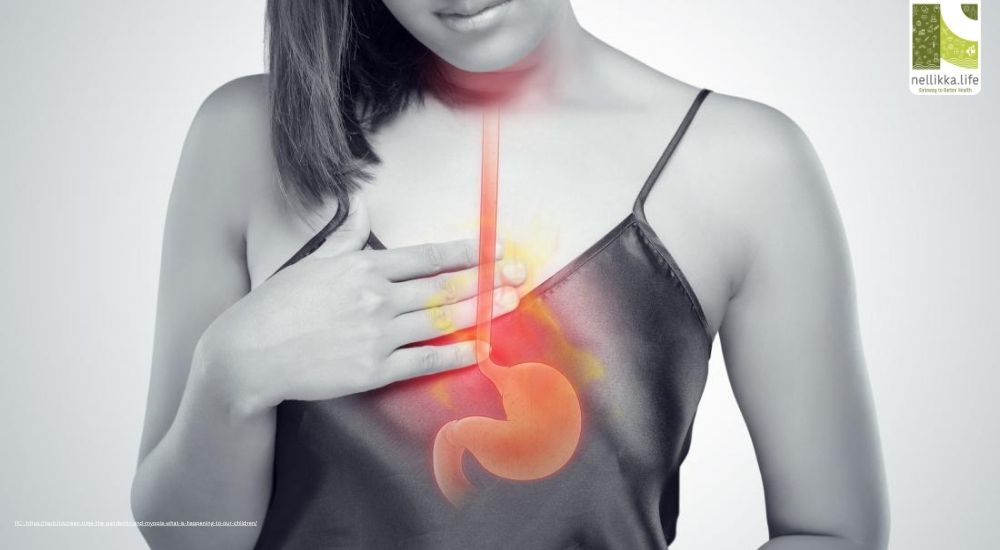 Silent Burn: How Acid Reflux Damages Your Throat Without Heartburn