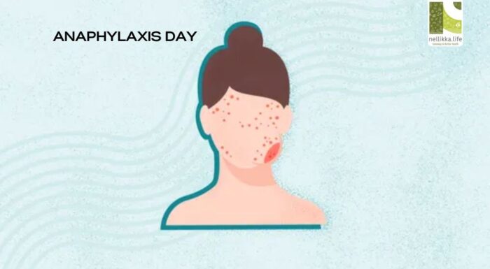 Anaphylaxis Day 2025: Understanding the Allergy Emergency That Can Save Lives