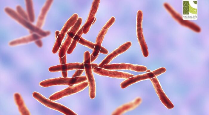 Buruli Ulcer: The Silent Skin Infection That Destroys Without Pain