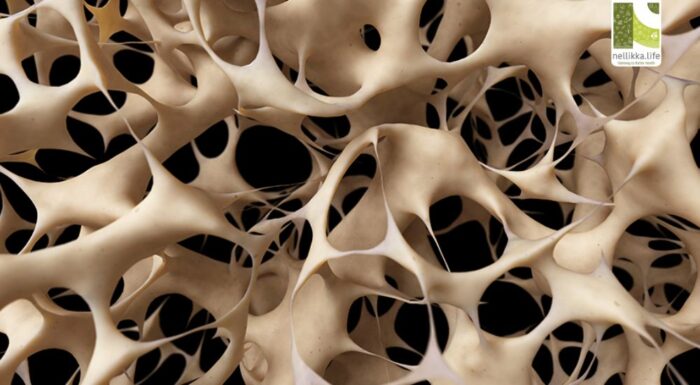 Brittle Truth: Understanding Osteoporosis Before It Breaks You