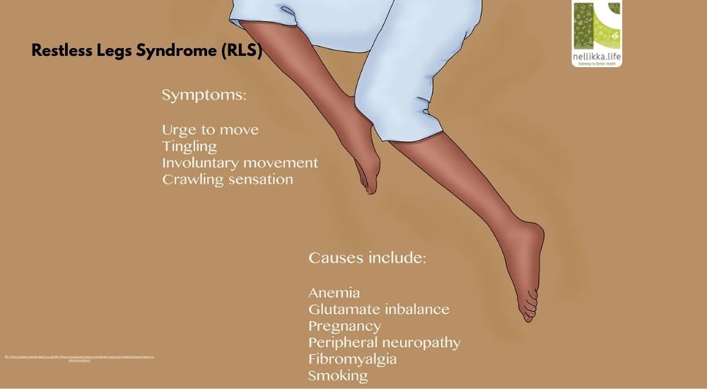 റെസ്റ്റ്ലെസ് ലെഗ്സ് സിൻഡ്രോം (RLS): കാലുകളുടെ ചലനം അനിയന്ത്രിതമാകുമ്പോൾ