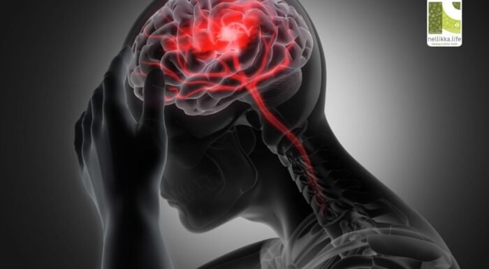 ഓരോ നിമിഷവും അമൂല്യം: പക്ഷാഘാത രോഗികളെ രക്ഷിക്കാൻ ഡോക്ടർമാർ കൈക്കൊള്ളുന്ന പുത്തൻ ചികിൽസാമാർഗ്ഗങ്ങൾ