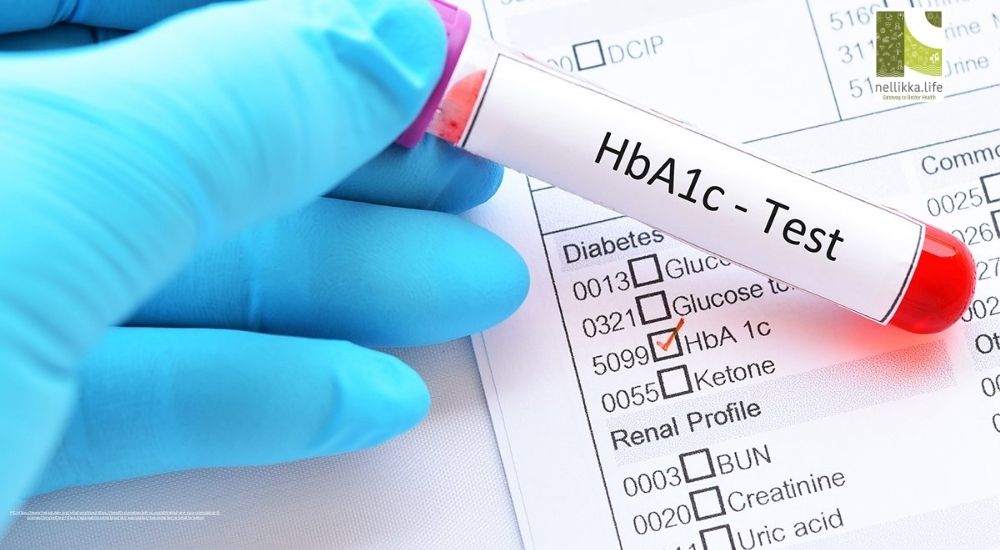 The A1C Test Explained: What Your Blood Says About the Last Three Months