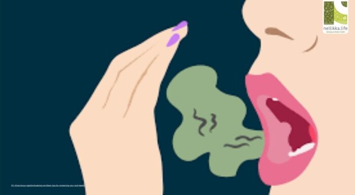 Bad Breath Decoded: Real Causes and Science-Backed Solutions