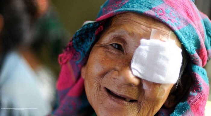 When the World Fades Too Soon: Why Women Face a Higher Risk of Preventable Blindness from Cataracts