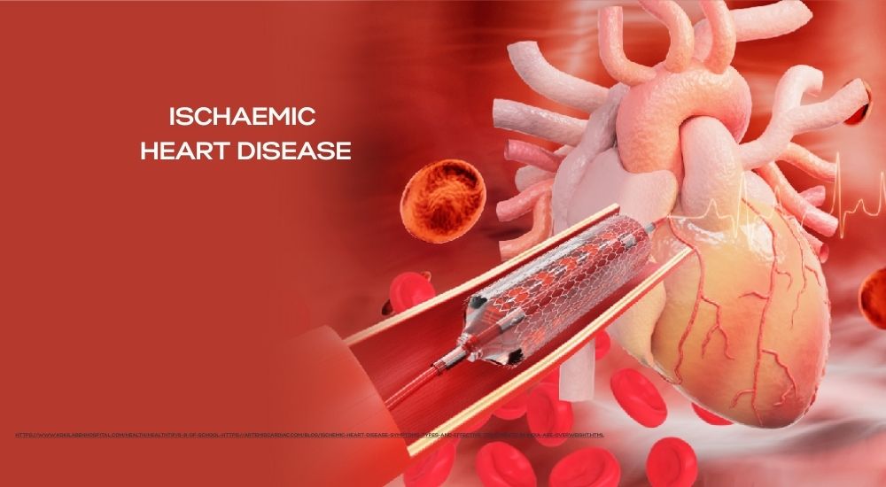 The Silent Block Inside: Understanding Ischaemic Heart Disease