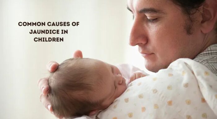 Jaundice in Children: What Parents and Teachers Must Take Care Of
