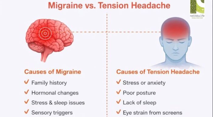 Migraines vs Tension Headaches: How to Tell the Difference