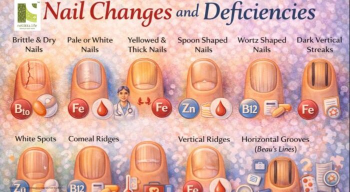 Nail Changes and Deficiencies: What Your Nails Reveal About Your Health