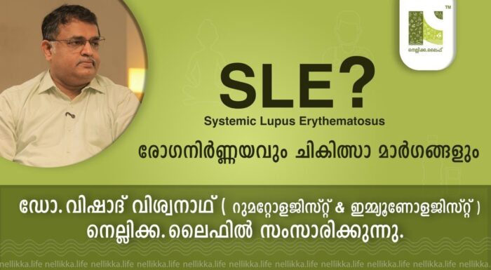 SLE ? രോഗനിർണ്ണയവും ചികിത്സാ മാർഗങ്ങളും.