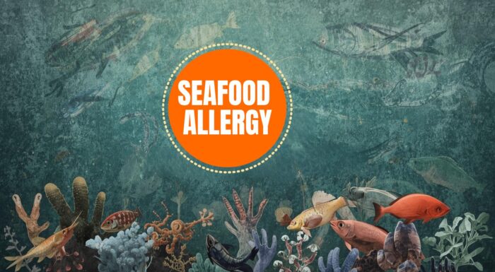Seafood Allergy, Fish Poisoning & Hidden Risks: What You Must Know