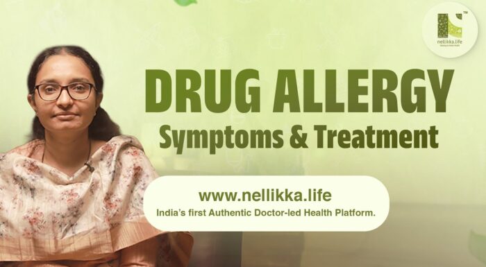 Drug Allergy Symptoms & Treatment.