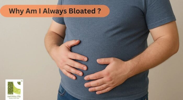 Why Am I Always Bloated?