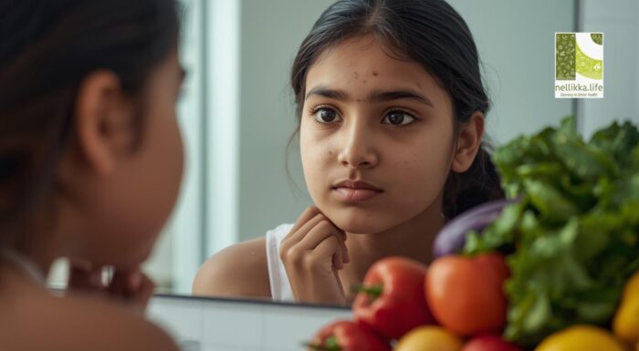 Acne and Diet: Does What You Eat Affect Your Skin?