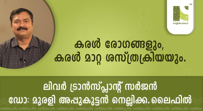 കരൾ രോഗങ്ങളും, കരൾ മാറ്റ ശസ്ത്രക്രിയയും