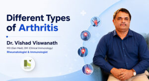 Rheumatoid Arthritis vs Osteoarthritis: Understanding the Difference